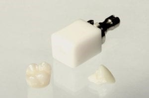 image of ceramic material for porcelain crown