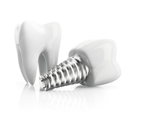 Dental implant and crown for info about a crown and post vs. an implant