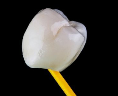 Dental crown, for information TMJ
